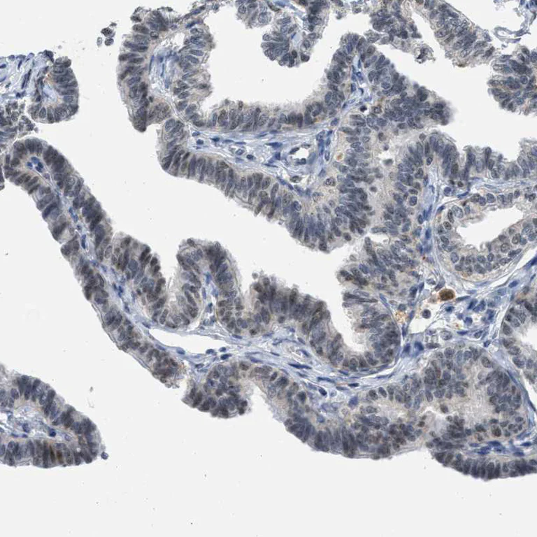 Immunohistochemistry (Formalin/PFA-fixed paraffin-embedded sections) - Anti-ELAC2 antibody (AB251725)