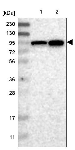 Western blot - Anti-ELAC2 antibody (AB251725), expandable thumbnail