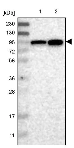 Western blot - Anti-ELAC2 antibody (AB251725)