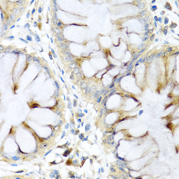 Immunohistochemistry (Formalin/PFA-fixed paraffin-embedded sections) - Anti-Elafin/ESI antibody (AB192345), expandable thumbnail