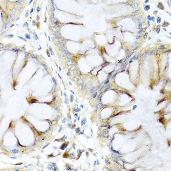 Immunohistochemistry (Formalin/PFA-fixed paraffin-embedded sections) - Anti-Elafin/ESI antibody (AB192345)