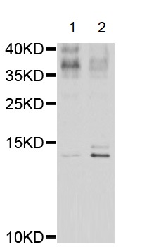 Western blot - Anti-Elafin/ESI antibody (AB192345), expandable thumbnail
