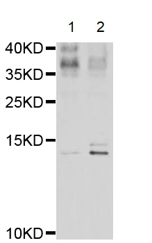 Western blot - Anti-Elafin/ESI antibody (AB192345)