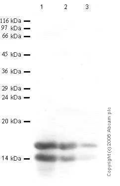 Western blot - Anti-Elafin/ESI antibody (AB46774)