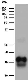 Western blot - Anti-Elafin/ESI antibody [EPR14631] (AB184972)