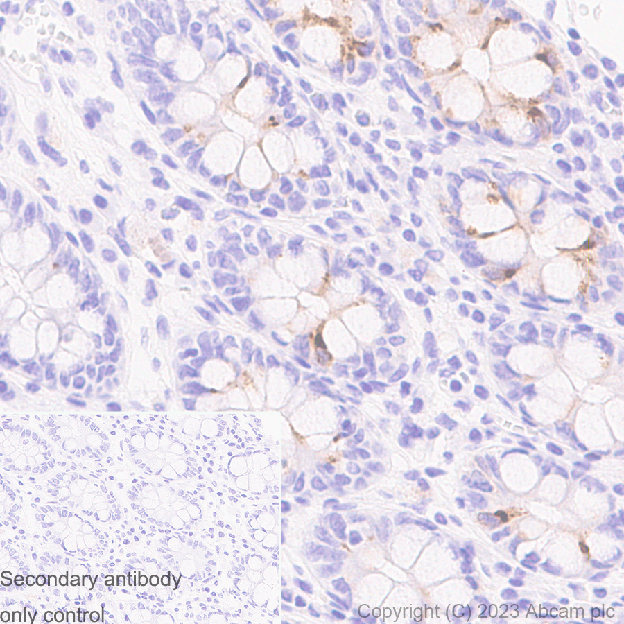 Immunohistochemistry (Formalin/PFA-fixed paraffin-embedded sections) - Anti-Elafin/ESI antibody [EPR14631] - BSA and Azide free (AB236135), expandable thumbnail
