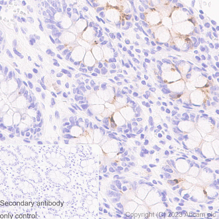 Immunohistochemistry (Formalin/PFA-fixed paraffin-embedded sections) - Anti-Elafin/ESI antibody [EPR14631] - BSA and Azide free (AB236135)