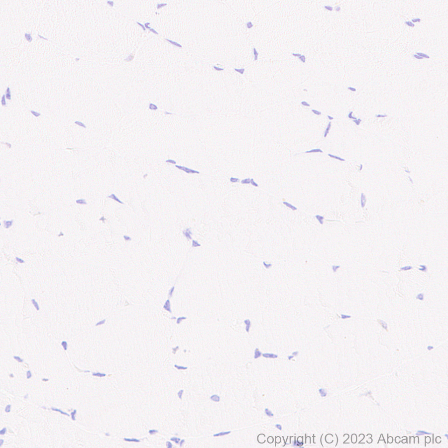 Immunohistochemistry (Formalin/PFA-fixed paraffin-embedded sections) - Anti-Elafin/ESI antibody [EPR14631] - BSA and Azide free (AB236135), expandable thumbnail