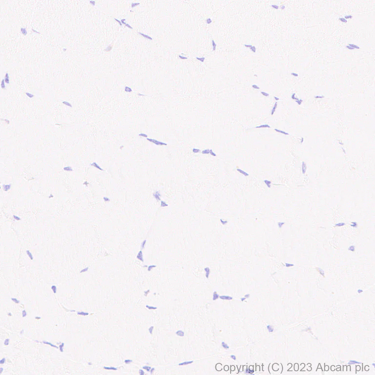 Immunohistochemistry (Formalin/PFA-fixed paraffin-embedded sections) - Anti-Elafin/ESI antibody [EPR14631] - BSA and Azide free (AB236135)