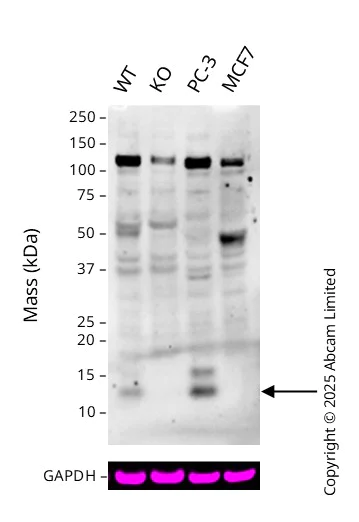 Western blot - Anti-Elafin/ESI antibody [EPR14631] - BSA and Azide free (AB236135)