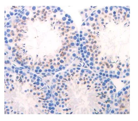 Immunohistochemistry (Formalin/PFA-fixed paraffin-embedded sections) - Anti-Elastase-1 antibody (AB231117)