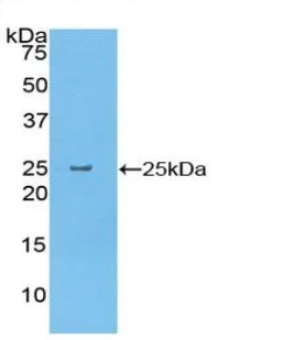 Western blot - Anti-Elastase-1 antibody (AB231117)