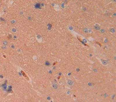 Immunohistochemistry (Formalin/PFA-fixed paraffin-embedded sections) - Anti-Elastase-1 antibody (AB231120)