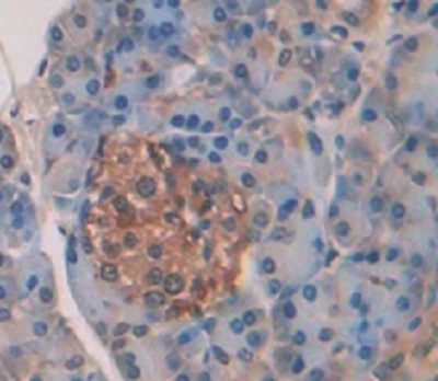 Immunohistochemistry (Formalin/PFA-fixed paraffin-embedded sections) - Anti-Elastase 3A antibody (AB232708), expandable thumbnail