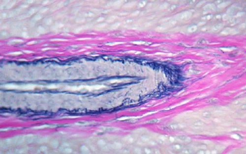 Immunohistochemistry (Formalin/PFA-fixed paraffin-embedded sections) - Elastic Stain Kit (Verhoeff Van Gieson / EVG Stain) (AB150667)