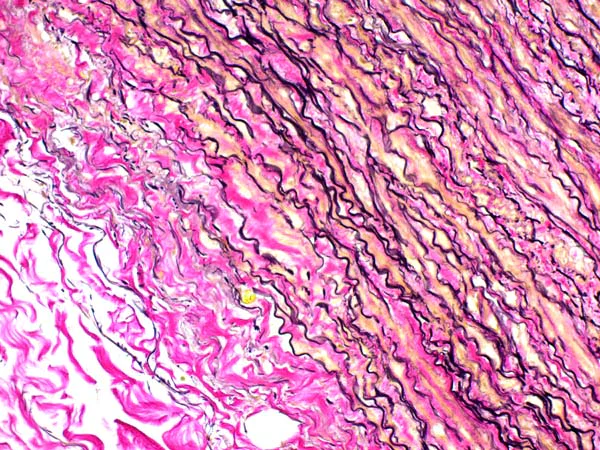 Immunohistochemistry (Formalin/PFA-fixed paraffin-embedded sections) - Elastic Stain Kit (Verhoeff Van Gieson / EVG Stain) (AB150667)