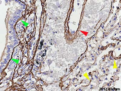 Immunohistochemistry (Formalin/PFA-fixed paraffin-embedded sections) - Anti-Elastin antibody [10B8] (AB77804)
