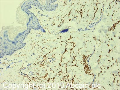 Immunohistochemistry (Formalin/PFA-fixed paraffin-embedded sections) - Anti-Elastin antibody [10B8] - BSA and Azide free (AB237975), expandable thumbnail