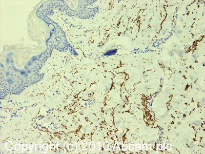 Immunohistochemistry (Formalin/PFA-fixed paraffin-embedded sections) - Anti-Elastin antibody [10B8] - BSA and Azide free (AB237975)
