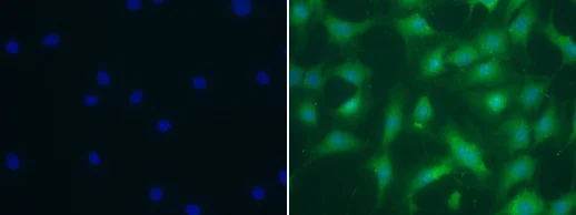 Immunocytochemistry - Anti-Elastin antibody (AB21610)