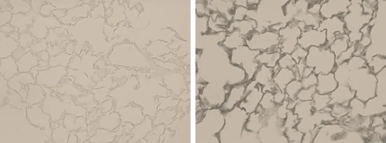 Immunohistochemistry (Formalin/PFA-fixed paraffin-embedded sections) - Anti-Elastin antibody (AB21610)