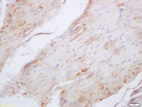 Immunohistochemistry (Formalin/PFA-fixed paraffin-embedded sections) - Anti-Elastin antibody (AB216681)