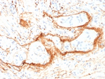 Immunohistochemistry (Formalin/PFA-fixed paraffin-embedded sections) - Anti-Elastin antibody [ELN/1981] - BSA and Azide free (AB237831), expandable thumbnail