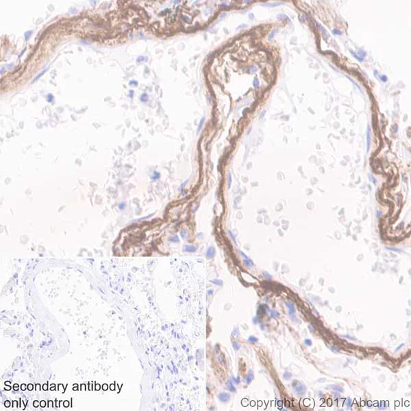 Immunohistochemistry (Formalin/PFA-fixed paraffin-embedded sections) - Anti-Elastin antibody [EPR20603] (AB213720)