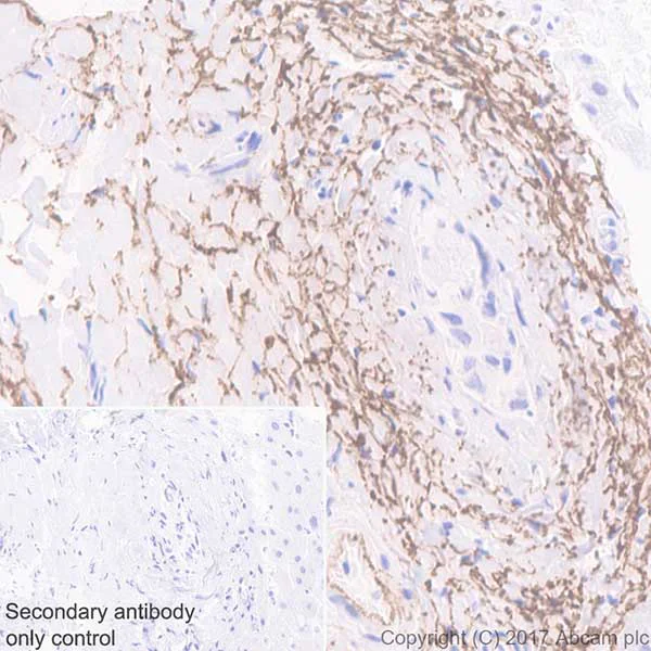 Immunohistochemistry (Formalin/PFA-fixed paraffin-embedded sections) - Anti-Elastin antibody [EPR20603] (AB213720)