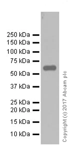 Western blot - Anti-Elastin antibody [EPR20603] (AB213720)