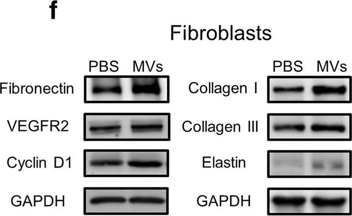 Western blot - Anti-Elastin antibody [EPR20603] (AB213720)