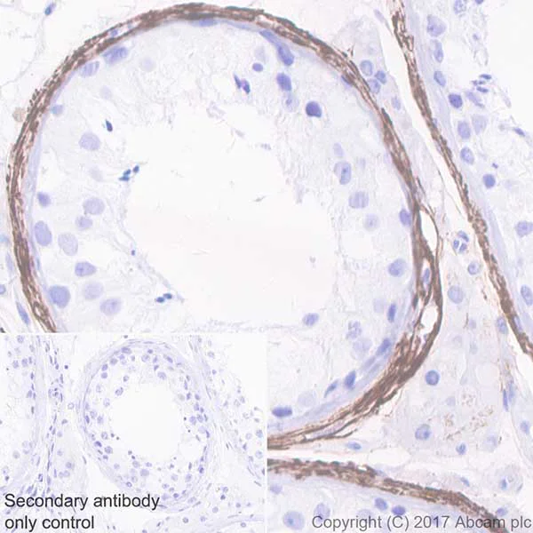 Immunohistochemistry (Formalin/PFA-fixed paraffin-embedded sections) - Anti-Elastin antibody [EPR20603] - BSA and Azide free (AB238981)
