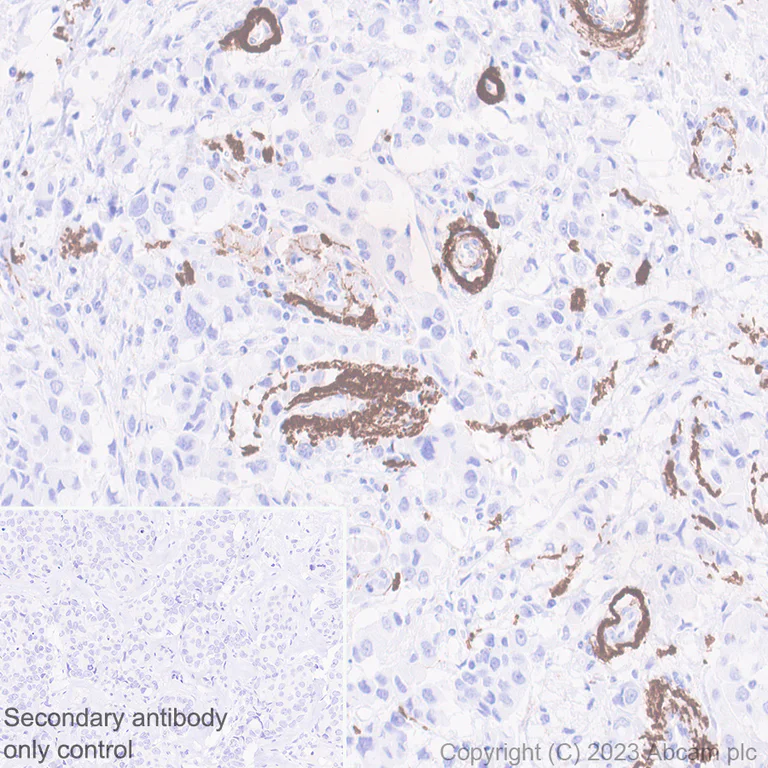 Immunohistochemistry (Formalin/PFA-fixed paraffin-embedded sections) - Anti-Elastin antibody [EPR20603] - BSA and Azide free (AB238981)