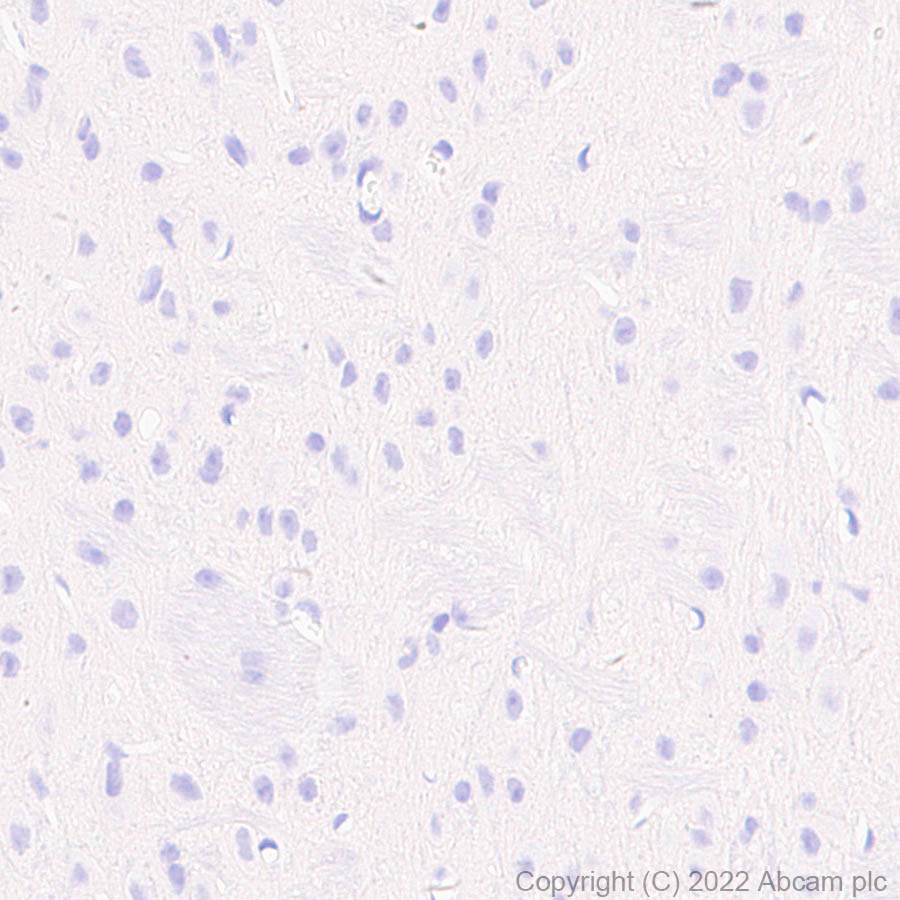Immunohistochemistry - Anti-Elastin antibody [EPR26834-89] (ab307150), expandable thumbnail