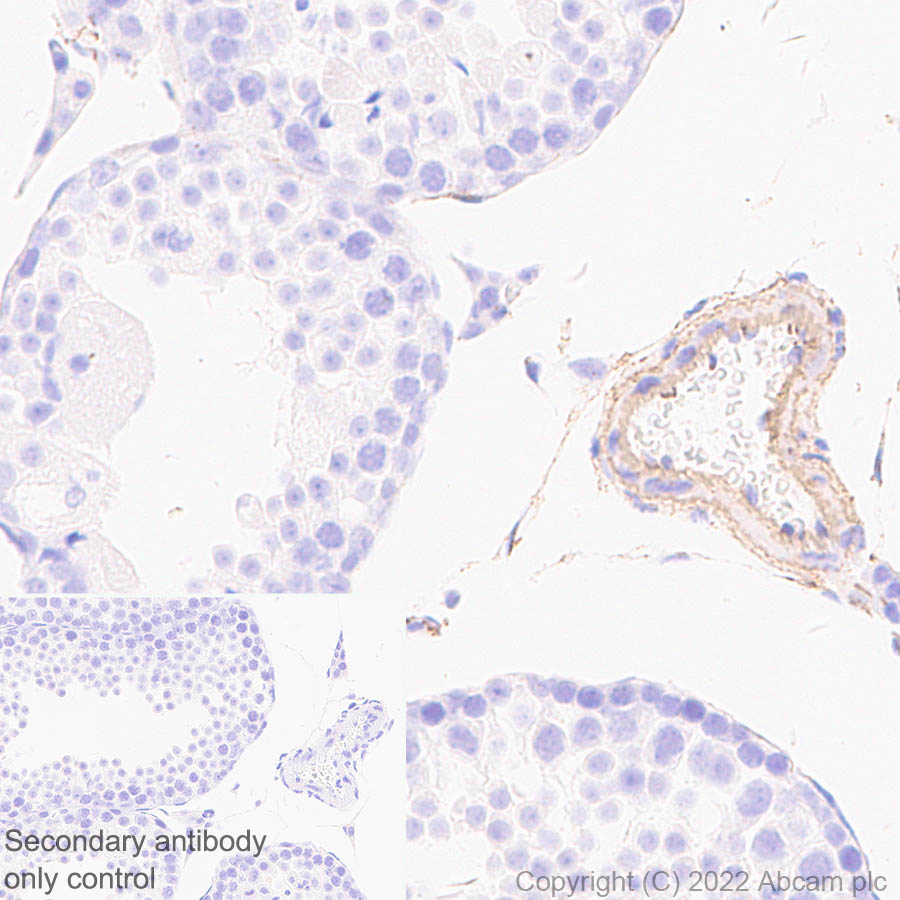 Immunohistochemistry - Anti-Elastin antibody [EPR26834-89] (ab307150), expandable thumbnail