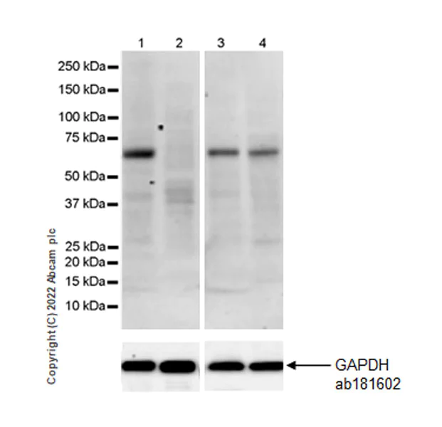 Western blot - Anti-Elastin antibody [EPR26834-89] (AB307150)