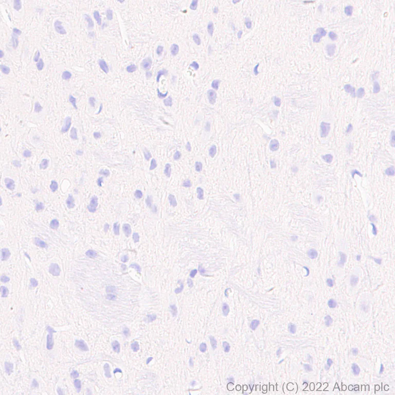 Immunohistochemistry - Anti-Elastin antibody [EPR26834-89] - BSA and Azide free (AB307151)