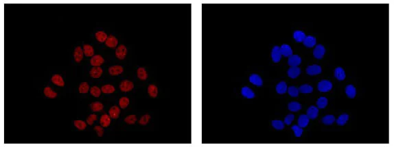 Immunocytochemistry/ Immunofluorescence - Anti-Elav-type RNA-binding protein ETR3 antibody [EPR13374-2] (AB186430)