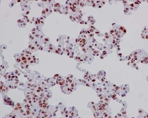 Immunohistochemistry (Formalin/PFA-fixed paraffin-embedded sections) - Anti-Elav-type RNA-binding protein ETR3 antibody [EPR13374-2] (AB186430)