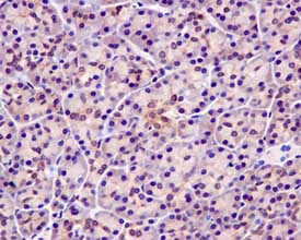 Immunohistochemistry (Formalin/PFA-fixed paraffin-embedded sections) - Anti-Elav-type RNA-binding protein ETR3 antibody [EPR13374] (AB179447), expandable thumbnail