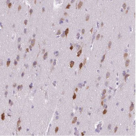 Immunohistochemistry (Formalin/PFA-fixed paraffin-embedded sections) - Anti-ELAVL2 antibody (AB204991)