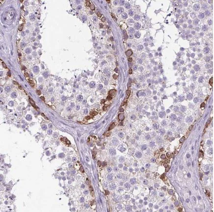 Immunohistochemistry (Formalin/PFA-fixed paraffin-embedded sections) - Anti-ELAVL2 antibody (AB204991)