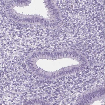 Immunohistochemistry (Formalin/PFA-fixed paraffin-embedded sections) - Anti-ELAVL2 antibody (AB204991)