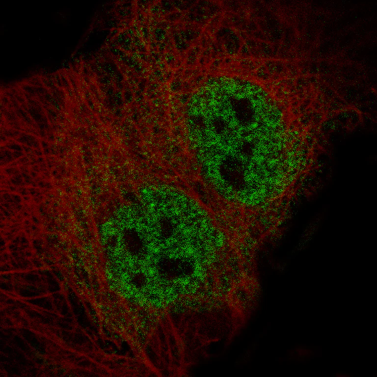 Immunocytochemistry/ Immunofluorescence - Anti-ELAVL2 Antibody [CL15323] (AB327161)