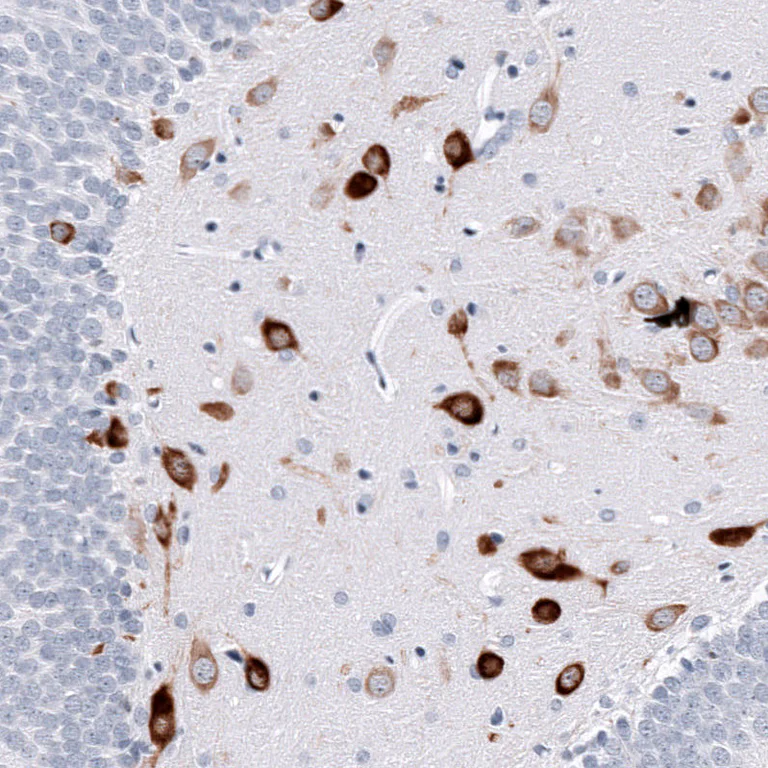 Immunohistochemistry (Formalin/PFA-fixed paraffin-embedded sections) - Anti-ELAVL2 Antibody [CL15323] (AB327161)