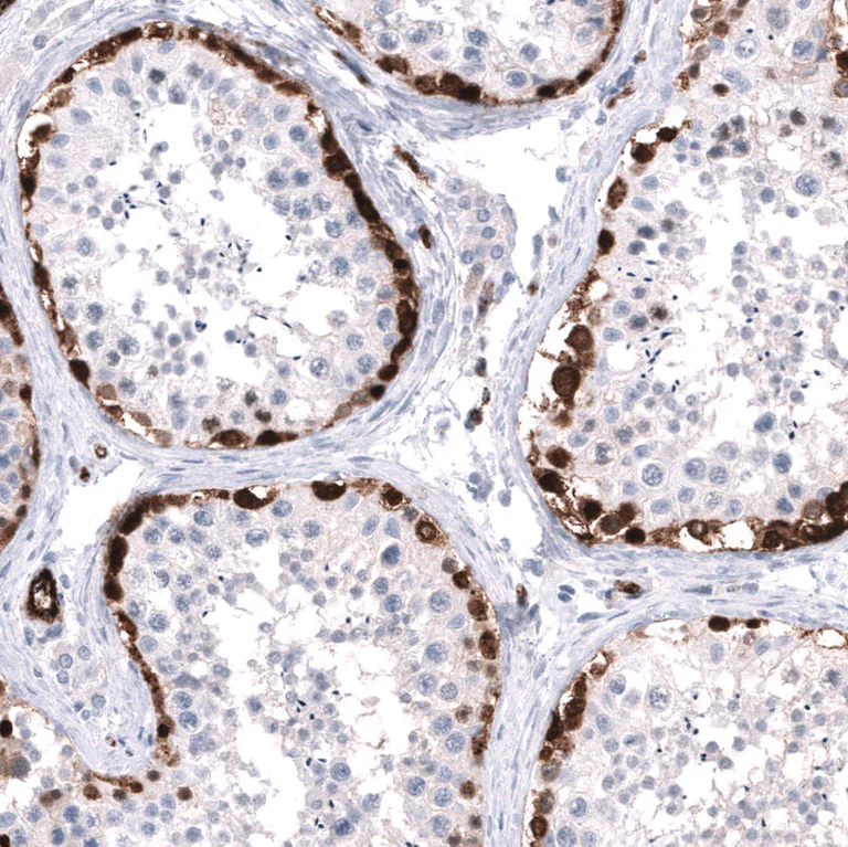 Immunohistochemistry (Formalin/PFA-fixed paraffin-embedded sections) - Anti-ELAVL2 Antibody [CL15323] (AB327161)