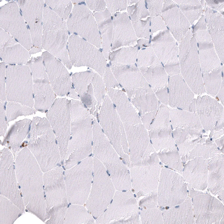 Immunohistochemistry (Formalin/PFA-fixed paraffin-embedded sections) - Anti-ELAVL2 Antibody [CL15323] (AB327161)