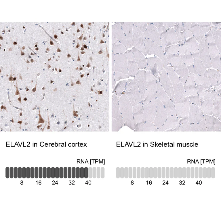 Immunohistochemistry (Formalin/PFA-fixed paraffin-embedded sections) - Anti-ELAVL2 Antibody [CL15323] (AB327161)