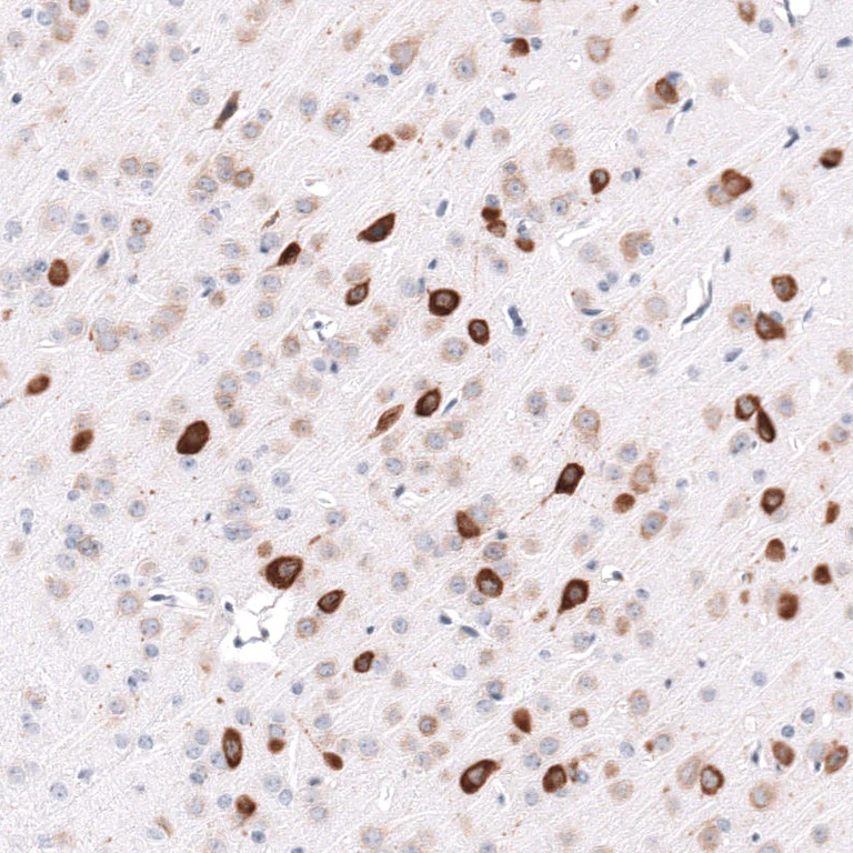 Immunohistochemistry (Formalin/PFA-fixed paraffin-embedded sections) - Anti-ELAVL2 Antibody [CL15323] (AB327161)