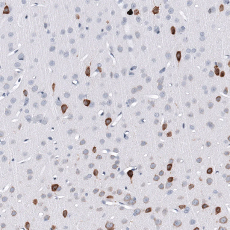 Immunohistochemistry (Formalin/PFA-fixed paraffin-embedded sections) - Anti-ELAVL2 Antibody [CL15323] (AB327161)